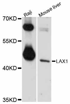 LAX1 / LAX Antibody
