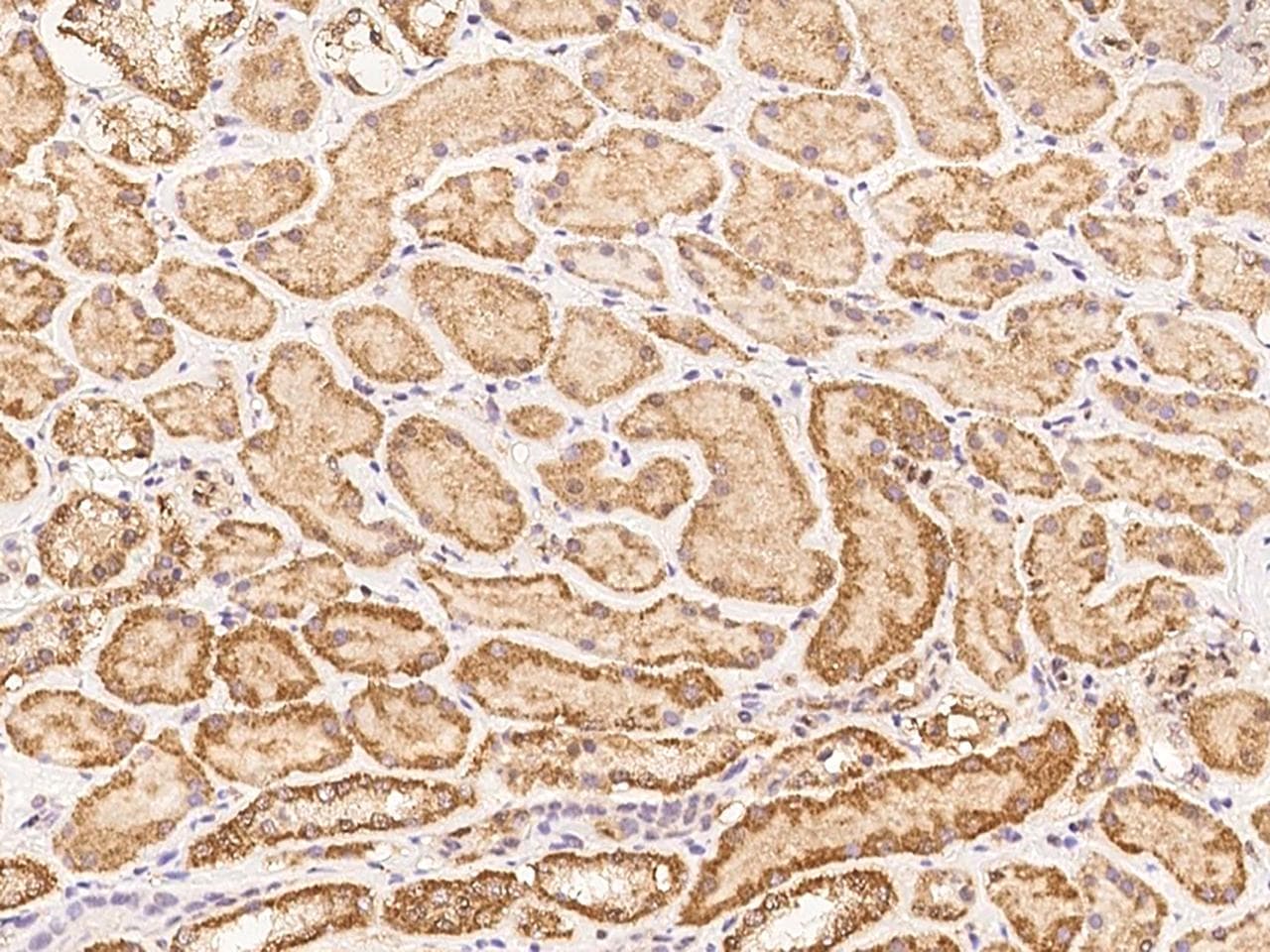 Polyclonal Rabbit anti-Human ARHGEF25 / GEFT Antibody (IHC)