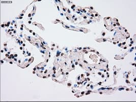 PLK1 / PLK-1 Antibody (clone OTI1A2)