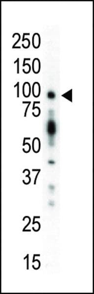 Polyclonal Rabbit anti-Human PRKD1 / PKC Mu Antibody (aa361-389, IHC, WB)