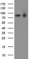 PRKCE / PKC-Epsilon Antibody (clone OTI1B4)