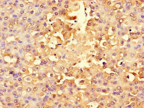 RPS6 / Ribosomal Protein S6 Antibody