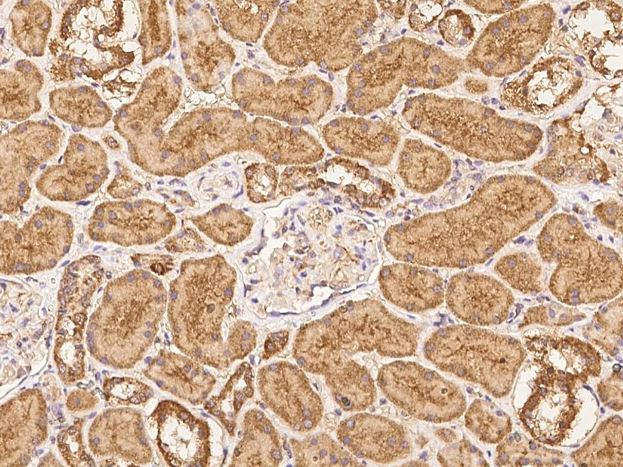 Polyclonal Rabbit anti-Human NAGPA Antibody (IHC)