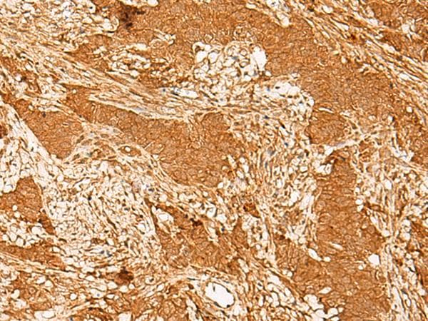 Polyclonal Rabbit anti-Human GTF3C3 Antibody (IHC)