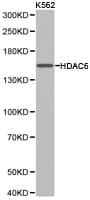 Polyclonal Rabbit anti-Human HDAC6 Antibody (IHC, WB)