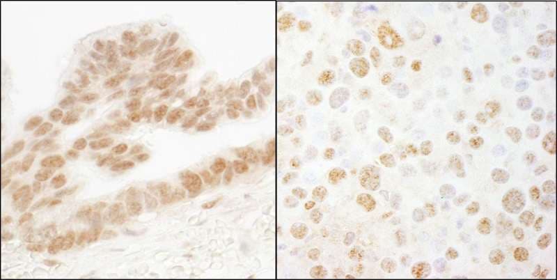 Polyclonal Rabbit anti-Human ERF / PE2 Antibody (aa200-250)