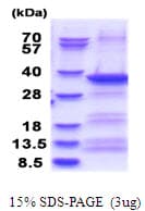 Human EXOSC3 Protein (Recombinant His)