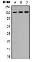 IHC-plus™ EPHB2 / EPH Receptor B2 Antibody (C-Terminus)