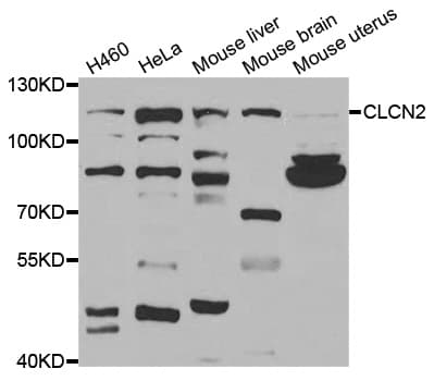 CLCN2 Antibody