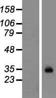 GPM6A / Glycoprotein M6A (Over-Expression Lysate Myc-DDK (Flag))