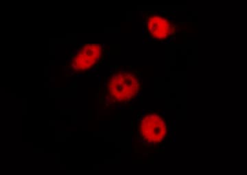 HNRNPC / HNRNP C Antibody