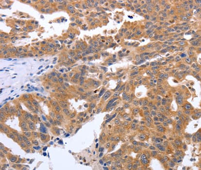 Polyclonal Rabbit anti-Human SIP1 Antibody (IHC, IF, WB)