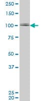 ZNF281 / Zfp281 Antibody (clone 1C9)