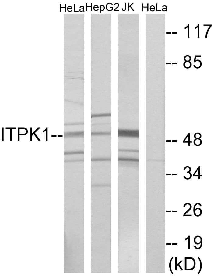 IHC-plus™ Polyclonal Rabbit anti-Human ITPK1 Antibody (aa81-130, IHC, WB)