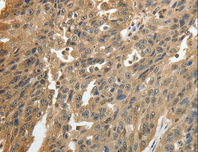 GSR / Glutathione Reductase Antibody
