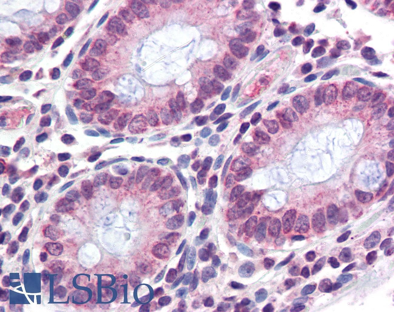 IHC-plus™ Polyclonal Rabbit anti-Human TMPRSS4 Antibody (N-Terminus, IHC)