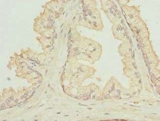 Polyclonal Rabbit anti-Human RGS5 Antibody (IHC)
