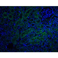 TRAIL-R4 / DCR2 Antibody