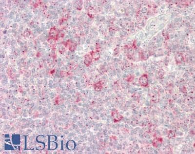 RBPJ Antibody (aa331-380)