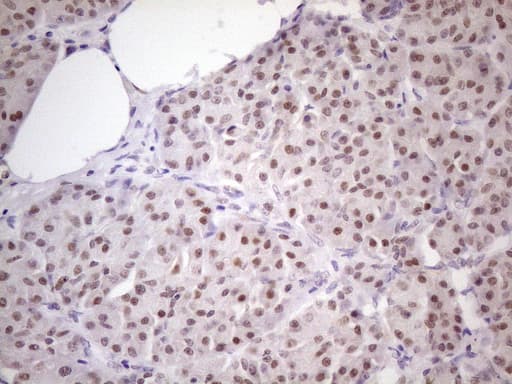ZNF200 Antibody (clone OTI5F4)