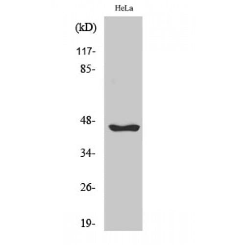SERPINB12 Antibody (210-290 aa, Internal)