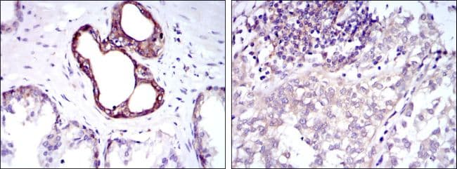 NFKB1 / NF-Kappa-B Antibody (clone 5D10)