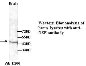 Polyclonal Rabbit anti-Human ENO2 / NSE Antibody (WB)