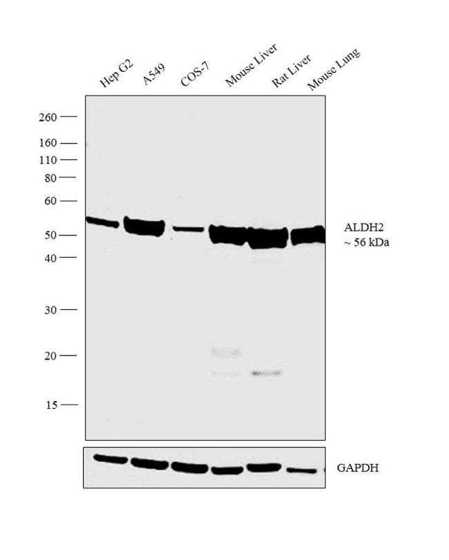 Monoclonal Mouse anti-Human ALDH2 Antibody (clone 4G6A3, Amino Acid: 317-517, IHC, IF, WB)
