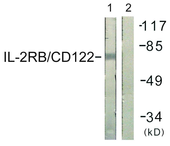 IL2RB / CD122 Antibody (p364)