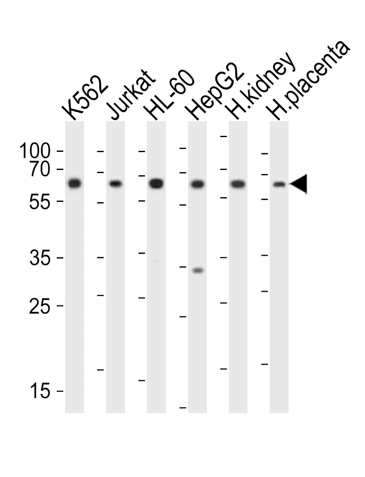 EPOR / EPO Receptor Antibody (aa470-504)