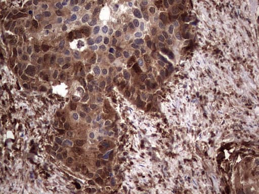LGALS3 / Galectin 3 Antibody (clone OTI7G9, Carrier-free)