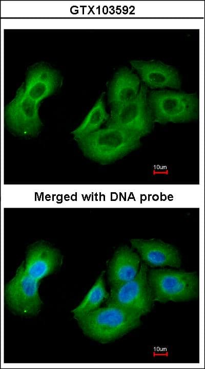 Polyclonal Rabbit anti-Human UAP1 Antibody (aa53-473, IHC, WB)