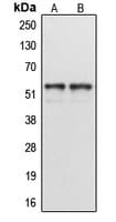 Polyclonal Rabbit anti-Human Cytochrome P450 CYP1A1/2 Antibody (Internal, IHC, IF, WB)