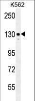 ITGA8 / Integrin Alpha 8 Antibody (aa1025-1053)