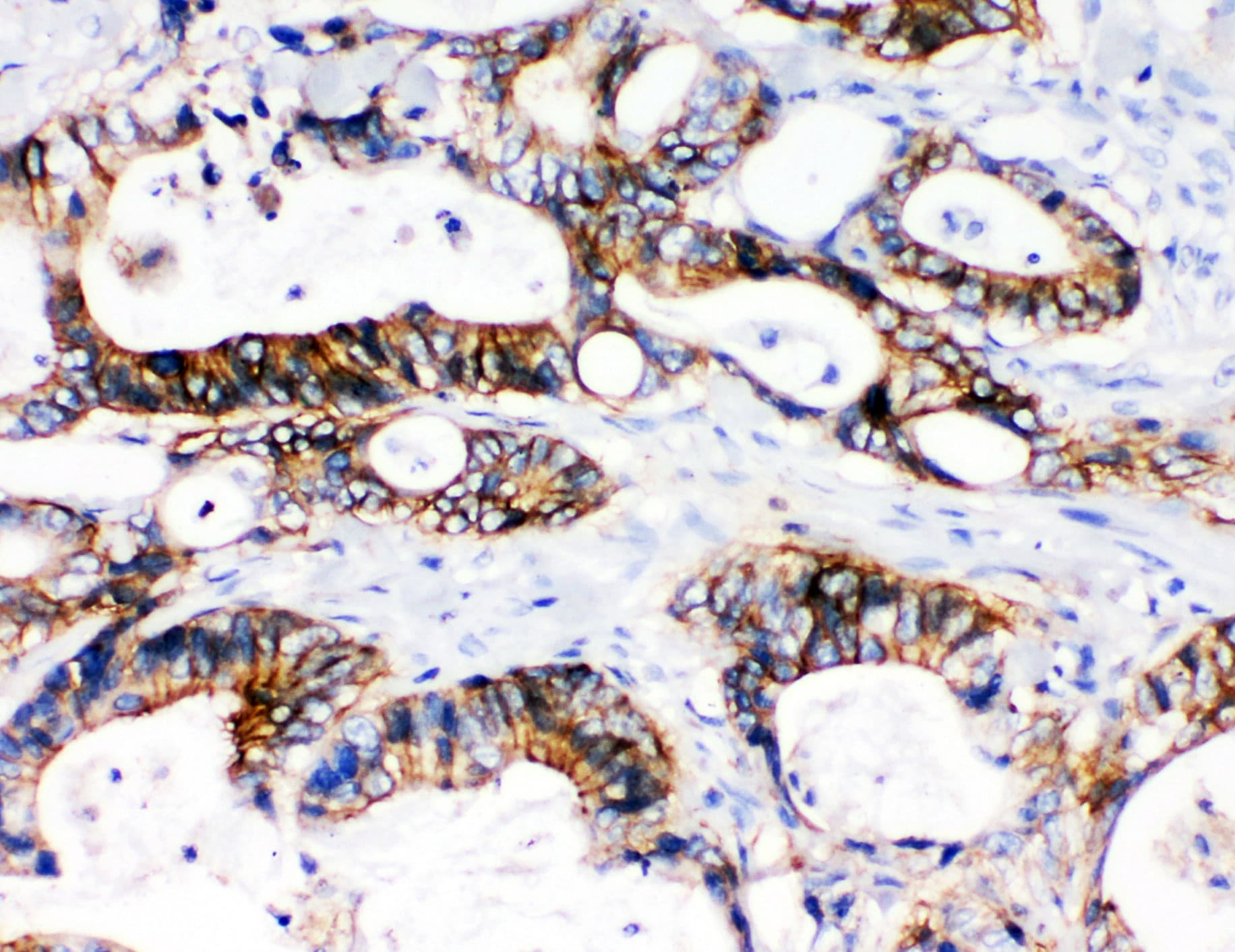 SLC12A2 / NKCC1 Antibody (aa223-241)