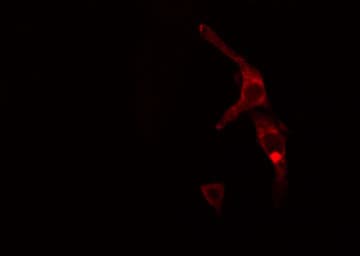 TBL2 Antibody