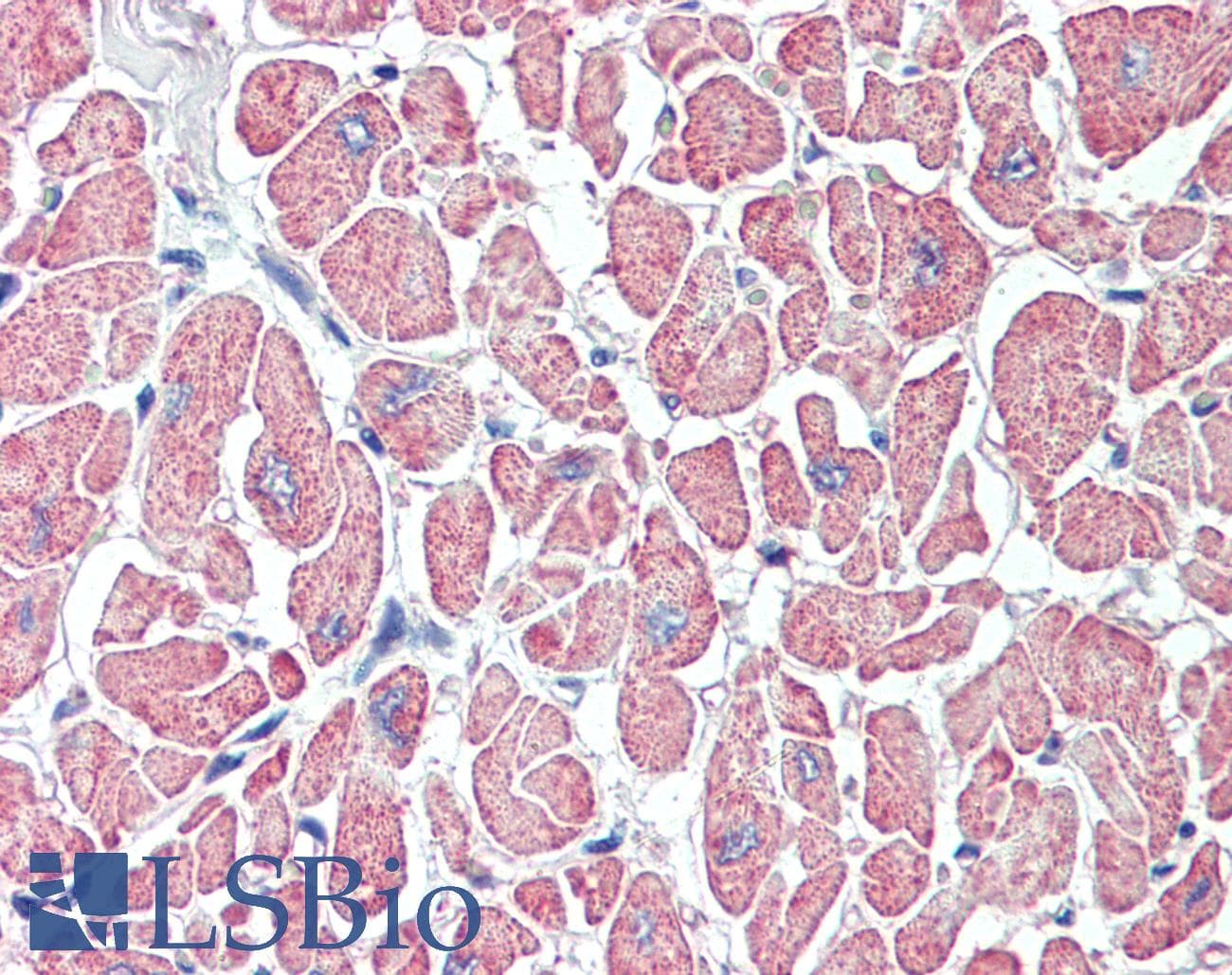 IHC-plus™ SLITRK6 Antibody (Internal)