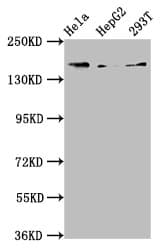 Complement C4a Antibody (aa1027-1186)