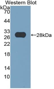 TPO / Thyroid Peroxidase Antibody (aa636-832)