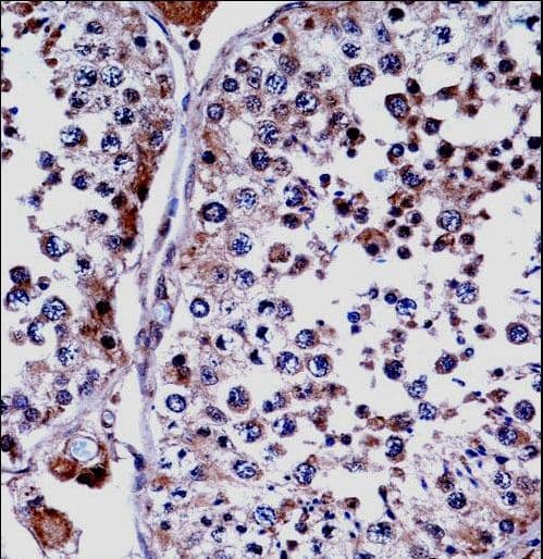 DUSP15 Antibody (aa125-153)