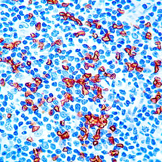 GYPA / CD235a / Glycophorin A Antibody (clone JC159)