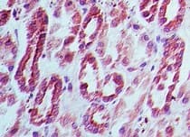 Polyclonal Rabbit anti-Human DNMT3L Antibody (aa25-75, IHC, WB)