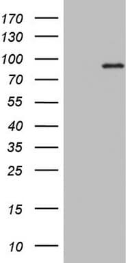 PLA2G6 / IPLA2 Antibody (aa490-752, clone OTI10A2)