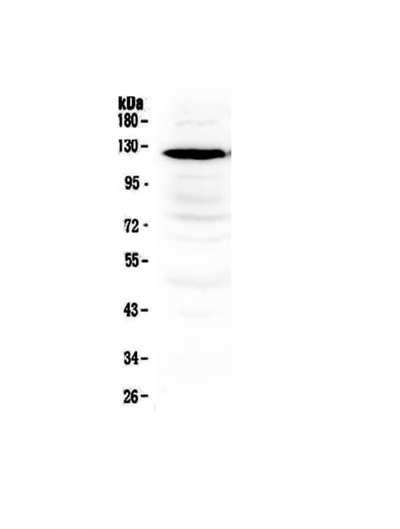 GRIN1 / NMDAR1 Antibody