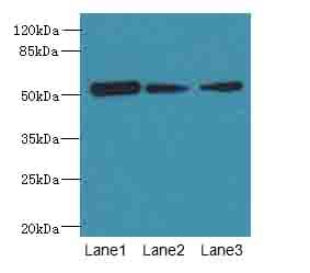 ARMT1 Antibody