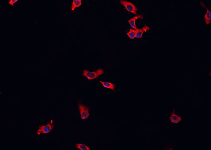 MAP3K8 / TPL2 Antibody