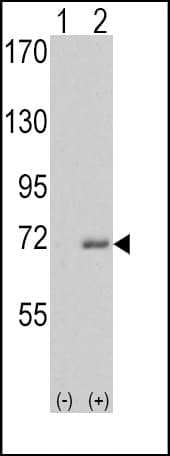 IHC-plus™ IRAK1 / IRAK Antibody (aa683-712)