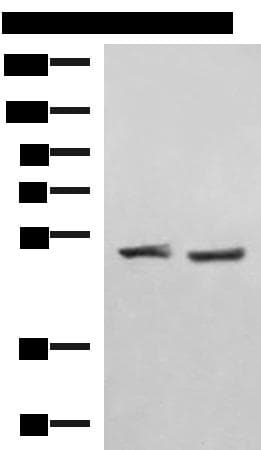 RRP8 Antibody