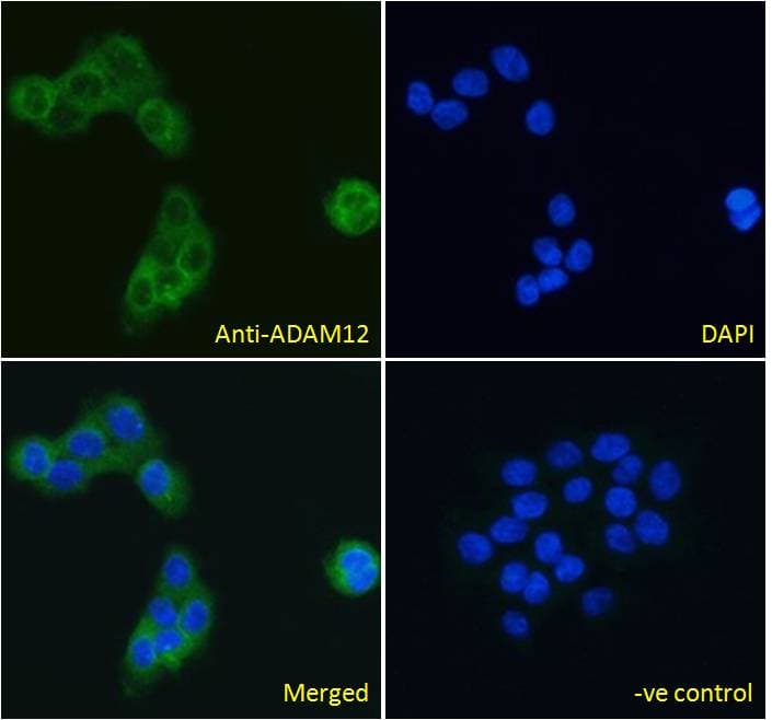 IHC-plus™ ADAM12 Antibody (aa2-14)