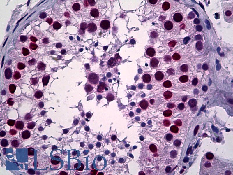 IHC-plus™ YY1 Antibody (clone 4A5)